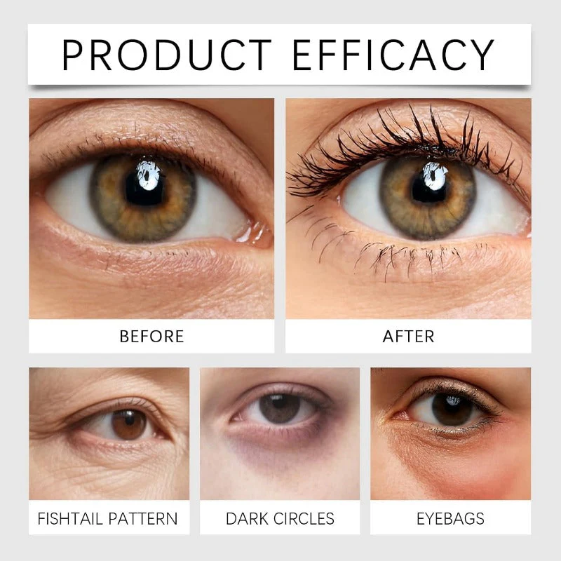 YoPoll Instant Eye Lift Cream Lifts & Refreshes Tired Eyes - Image 4