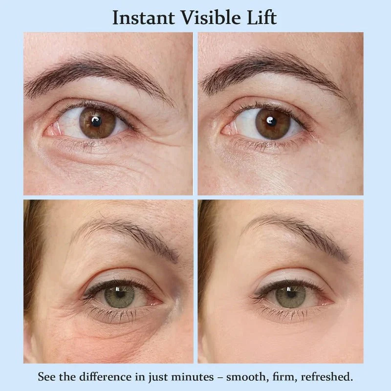 YoPoll Instant Eye Lift Cream Lifts & Refreshes Tired Eyes - Image 6